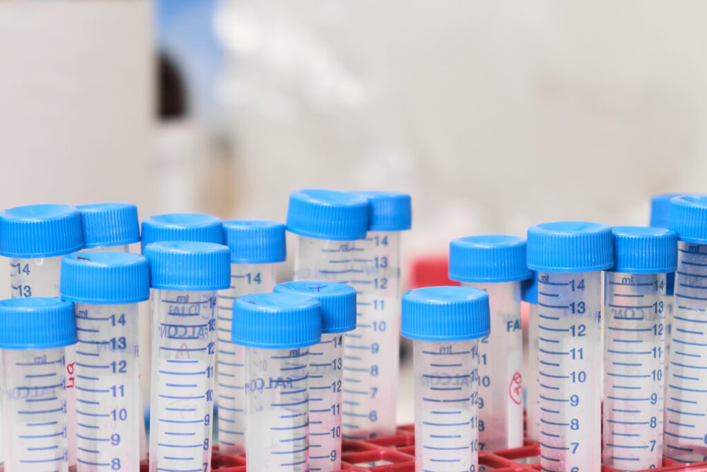 Urineonderzoek hond waardes